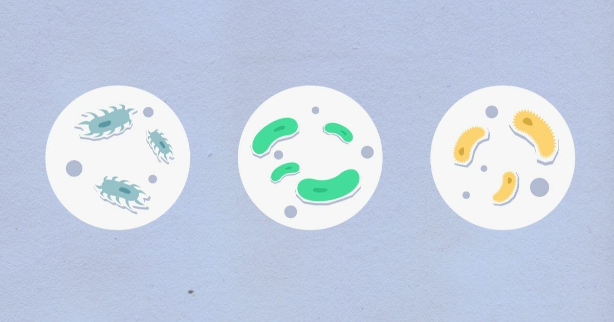 Perché l’argento disinfetta? Scoprilo, ti stupirà