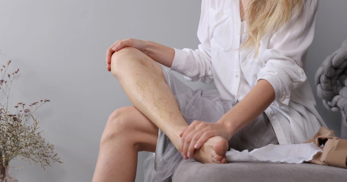 Integratori drenanti: cosa sono e a cosa servono?