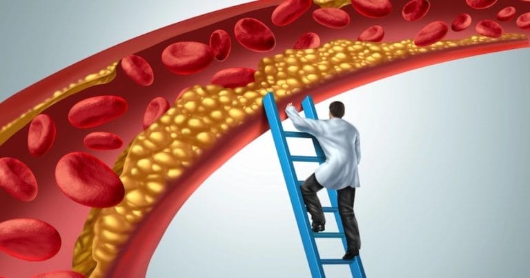 medico si arrampica su na scala verso le arterie intasate dal colesterolo